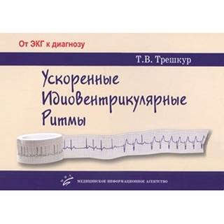 Ускоренные идиовентрикулярные ритмы: клинико-электрокардиографические особенности, систематизация по ЭКГ-характеристикам, дифференцирование с другими нарушениями ритма и аномалиями проводимости Трешкур Т.В. 2017 г. (МИА)