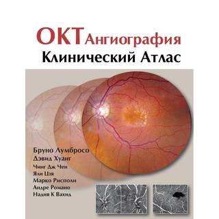 ОКТ-ангиография. Клинический атлас Бруно Лумбросо 2017 г. (gl)