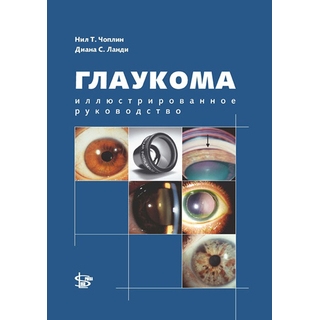 Глаукома. Иллюстрированное руководство Н.Т. Чоплин 2013 г. (gl)