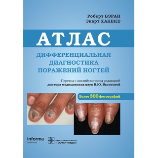 Дифференциальная диагностика поражений ногтей : атлас Роберт Бэран 2022 г. (Гэотар) Дифференциальная диагностика поражений ногтей : атлас Роберт Бэран 2022 г. (Гэотар)