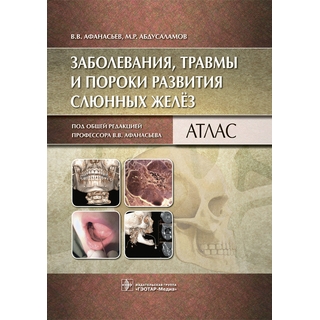 Заболевания, травмы и пороки развития слюнных желёз : атлас Афанасьев В.В. 2023 г. (Гэотар) Заболевания, травмы и пороки развития слюнных желёз : атлас Афанасьев В.В. 2023 г. (Гэотар)