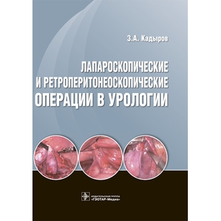 Лапароскопические и ретроперитонеоскопические операции в урологии З. А. Кадыров 2017 г. (Гэотар) Лапароскопические и ретроперитонеоскопические операции в урологии З. А. Кадыров 2017 г. (Гэотар)