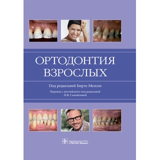 Ортодонтия взрослых под ред. Бирте Мелсен 2019 г. (Гэотар) Ортодонтия взрослых под ред. Бирте Мелсен 2019 г. (Гэотар)
