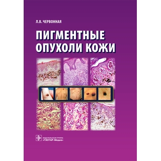 Пигментные опухоли кожи Червонная Л.В. 2016 г. (Гэотар) Пигментные опухоли кожи Червонная Л.В. 2016 г. (Гэотар)