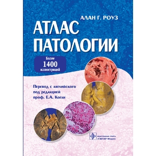 Атлас патологии Роуз А.Г. 2010 г. (Гэотар) Атлас патологии Роуз А.Г. 2010 г. (Гэотар)