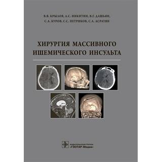 Хирургия массивного ишемического инсульта В. В. Крылов 2016 г. (Гэотар)