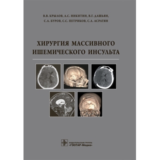 Хирургия массивного ишемического инсульта В. В. Крылов 2016 г. (Гэотар) Хирургия массивного ишемического инсульта В. В. Крылов 2016 г. (Гэотар)