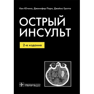 Острый инсульт. 2-е изд. Ючино К. Пари Дж. Гротта Дж. 2012 г. (Гэотар) Острый инсульт. 2-е изд. Ючино К. Пари Дж. Гротта Дж. 2012 г. (Гэотар)
