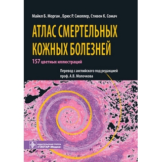 Атлас смертельных кожных болезней Морган М.Б. 2010 г. (Гэотар) Атлас смертельных кожных болезней Морган М.Б. 2010 г. (Гэотар)