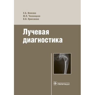 Лучевая диагностика Илясова Е.Б. 2016 г. (Гэотар) Лучевая диагностика Илясова Е.Б. 2016 г. (Гэотар)