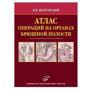 Атлас операций на органах брюшной полости Жебровский В.В. 2009 г. (МИА)