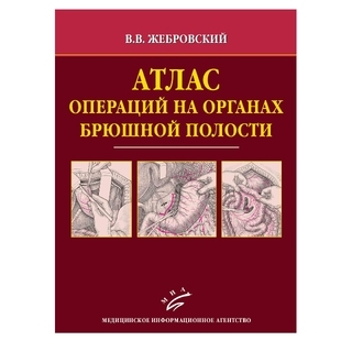 Атлас операций на органах брюшной полости Жебровский В.В. 2009 г. (МИА) Атлас операций на органах брюшной полости Жебровский В.В. 2009 г. (МИА)