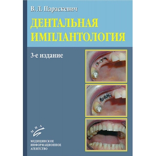 Дентальная имплантология 3-е изд. Параскевич В.Л. 2011 г. (МИА) Дентальная имплантология 3-е изд. Параскевич В.Л. 2011 г. (МИА)