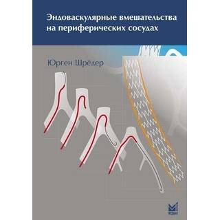 Эндоваскулярные вмешательства на периферических сосудах Шрёдер Ю. 2014 г. (МЕДпресс)