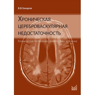 Хроническая цереброваскулярная недостаточность. Захаров 2023 г. (МЕДпресс) Хроническая цереброваскулярная недостаточность. Захаров 2023 г. (МЕДпресс)