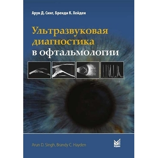 Ультразвуковая диагностика в офтальмологии. Синг А. 2025 г. (МЕДпресс) Ультразвуковая диагностика в офтальмологии. Синг А. 2025 г. (МЕДпресс)