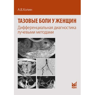 Тазовые боли у женщин Холин 2018 г. (МЕДпресс) Тазовые боли у женщин Холин 2018 г. (МЕДпресс)
