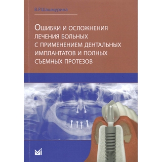 Ошибки и осложнения лечения больных с применением дентальных имплантов и полных съемных протезов Шашмурина В.Р. 2017 г. (МЕДпресс) Ошибки и осложнения лечения больных с применением дентальных имплантов и полных съемных протезов Шашмурина В.Р. 2017 г. (МЕДпресс)