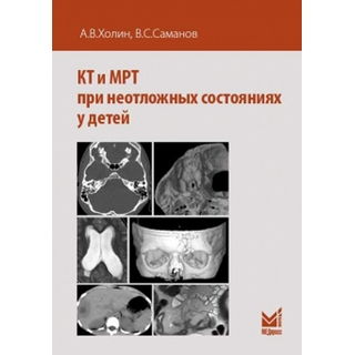 КТ и МРТ при неотложных состояниях у детей Холин 2019 г. (МЕДпресс) КТ и МРТ при неотложных состояниях у детей Холин 2019 г. (МЕДпресс)