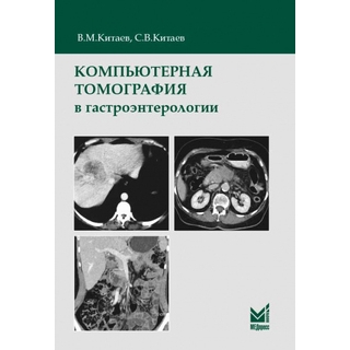 Компьютерная томография в гастроэнтерологии Китаев В.М. 2019 г. (МЕДпресс) Компьютерная томография в гастроэнтерологии Китаев В.М. 2019 г. (МЕДпресс)