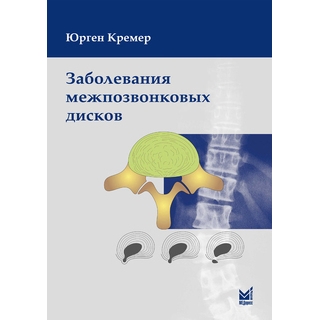 Заболевания межпозвонковых дисков Кремер 2015 г. (МЕДпресс) Заболевания межпозвонковых дисков Кремер 2015 г. (МЕДпресс)