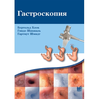 Гастроскопия Блок Б. 2024 г. (МЕДпресс) Гастроскопия Блок Б. 2024 г. (МЕДпресс)