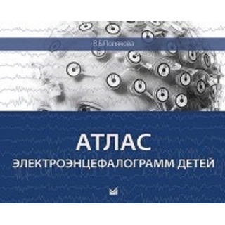 Атлас электроэнцефалограмм детей Полякова 2016 г. (МЕДпресс)