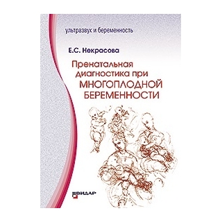 Пренатальная диагностика при многоплодной беременности. (УЗИ) Е.С. Некрасова 2019 г. (Видар)