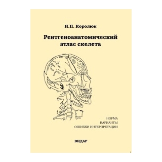 Рентгеноанатомический атлас скелета. Нормы, варианты, ошибки интерпретации. Изд.2-е И.П. Королюк 2008 г. (Видар) Рентгеноанатомический атлас скелета. Нормы, варианты, ошибки интерпретации. Изд.2-е И.П. Королюк 2008 г. (Видар)