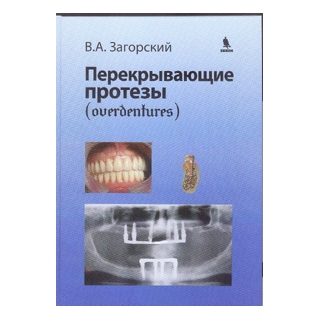 Перекрывающие протезы(overdentures) Загорский В.А. 2012 г. (Бином) Перекрывающие протезы(overdentures) Загорский В.А. 2012 г. (Бином)