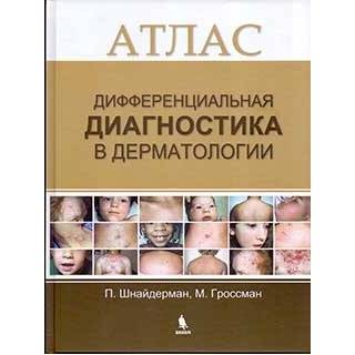 Дифференциальная диагностика в дерматологии. Атлас Шнайдерман П. Гроссман М. 2017 г. (Бином)