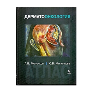 Дерматоонкология. Атлас Молочков А.В. 2015 г. (Бином) Дерматоонкология. Атлас Молочков А.В. 2015 г. (Бином)