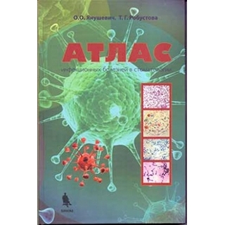 Атлас инфекционных болезней в стоматологии Янушевич О.О. Робустова Т.Г. 2017 г. (Бином)