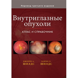 Внутриглазные опухоли. Атлас и справочник Шилдс Дж.А. Шилдс К.Л. 2018 г. (Издательство Панфилова) Внутриглазные опухоли. Атлас и справочник Шилдс Дж.А. Шилдс К.Л. 2018 г. (Издательство Панфилова)