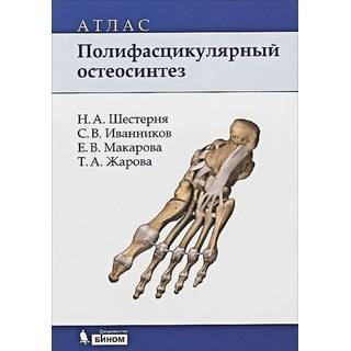 Полифасцикулярный остеосинтез: атлас Шестерня Н.А 2015 г. (Лаборатория знаний)
