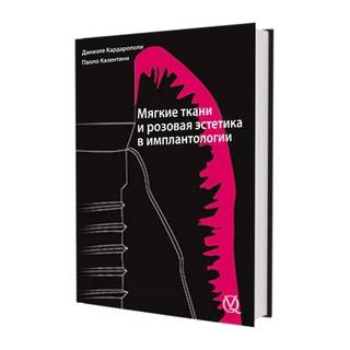 Эстетика мягких тканей в имплантологии. Даниэле Кардарополи 2020 г. (Дентал-Азбука)