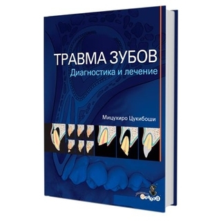 Травма зубов. Диагностика и лечение Мицухиро Цукибоши 2019 г. (Дентал-Азбука) Травма зубов. Диагностика и лечение Мицухиро Цукибоши 2019 г. (Дентал-Азбука)