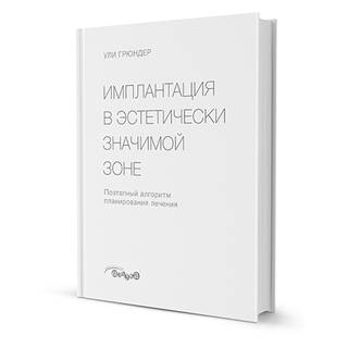 Имплантация в эстетически значимой зоне. Поэтапный алгоритм планирования лечения. Ули Грюндер 2017 г. (Дентал-Азбука)