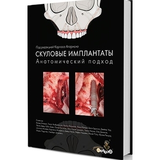 Скуловые имплантаты. Анатомический подход Карлос Апарисио 2017 г. (Дентал-Азбука) Скуловые имплантаты. Анатомический подход Карлос Апарисио 2017 г. (Дентал-Азбука)