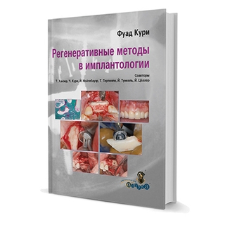 Регенеративные методы в имплантологии Фуад Кури 2013 г. (Дентал-Азбука) Регенеративные методы в имплантологии Фуад Кури 2013 г. (Дентал-Азбука)