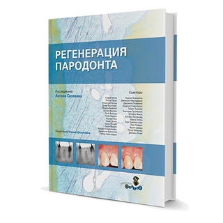 Регенерация пародонта А. Скулеан 2012 г. (Дентал-Азбука) Регенерация пародонта А. Скулеан 2012 г. (Дентал-Азбука)