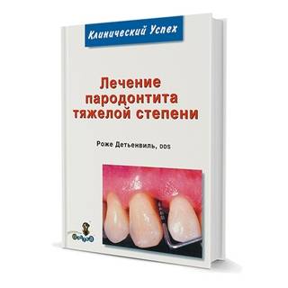 Лечение пародонтита тяжелой степени Роже Детьенвиль 2008 г. (Дентал-Азбука)