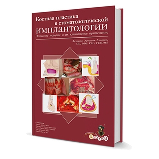 Костная пластика в стоматологической имплантологии. Описание методик и их клинического применения Ф.Э. Альфаро 2006 г. (Дентал-Азбука) Костная пластика в стоматологической имплантологии. Описание методик и их клинического применения Ф.Э. Альфаро 2006 г. (Дентал-Азбука)