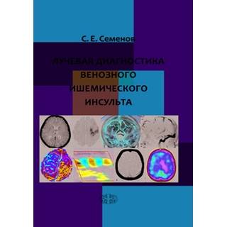 Лучевая диагностика венозного ишемического инсульта Семенов 2018 г. (Фолиант)
