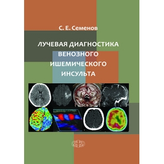 Лучевая диагностика венозного ишемического инсульта Семенов 2018 г. (Фолиант) Лучевая диагностика венозного ишемического инсульта Семенов 2018 г. (Фолиант)