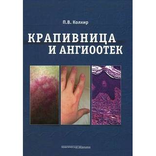 Крапивница и ангиоотек Колхир 2012 г. (Практическая медицина)