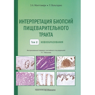 Интерпретация биопсий пищеварительного тракта. Том II. Новообразования Монтгомери 2019 г. (Практическая медицина) Интерпретация биопсий пищеварительного тракта. Том II. Новообразования Монтгомери 2019 г. (Практическая медицина)