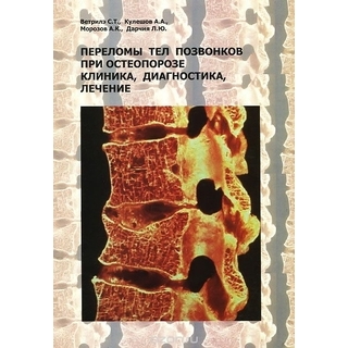 Переломы тел позвонков при остеопорозе. Клиника, диагностика, лечение Ветрилэ 2014 г. (Москва) Переломы тел позвонков при остеопорозе. Клиника, диагностика, лечение Ветрилэ 2014 г. (Москва)