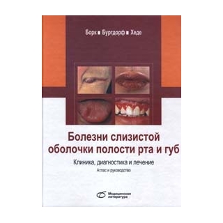 Болезни слизистой оболочки полости рта и губ. Клиника, диагностика и лечение К. Борк В. 2020 г. (Медицинская литература) Болезни слизистой оболочки полости рта и губ. Клиника, диагностика и лечение К. Борк В. 2020 г. (Медицинская литература)