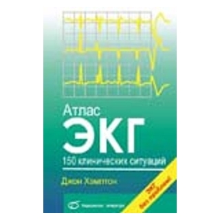 Атлас ЭКГ 150 клинических ситуаций Дж. Хэмптон 2008 г. (Медицинская литература) Атлас ЭКГ 150 клинических ситуаций Дж. Хэмптон 2008 г. (Медицинская литература)